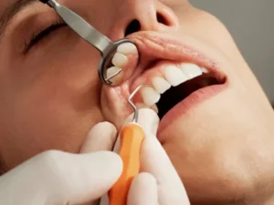 Preventive Hygiene – Dental Cleaning Vancouver