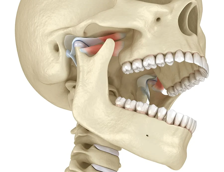 Expert TMJ Disorder (TMD) Specialist skelaton shown
