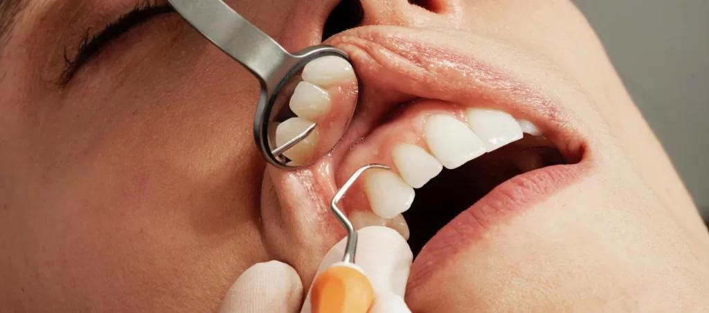 cosmetic dentistry