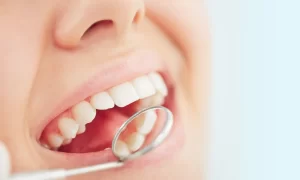 dental hygienist