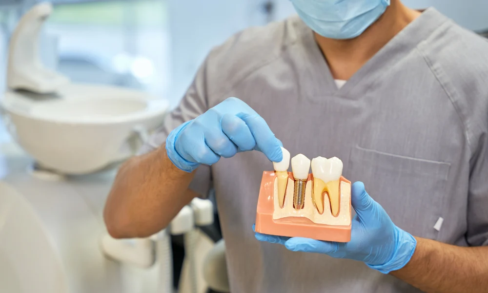 The Advancements in Dental Implant Technology
