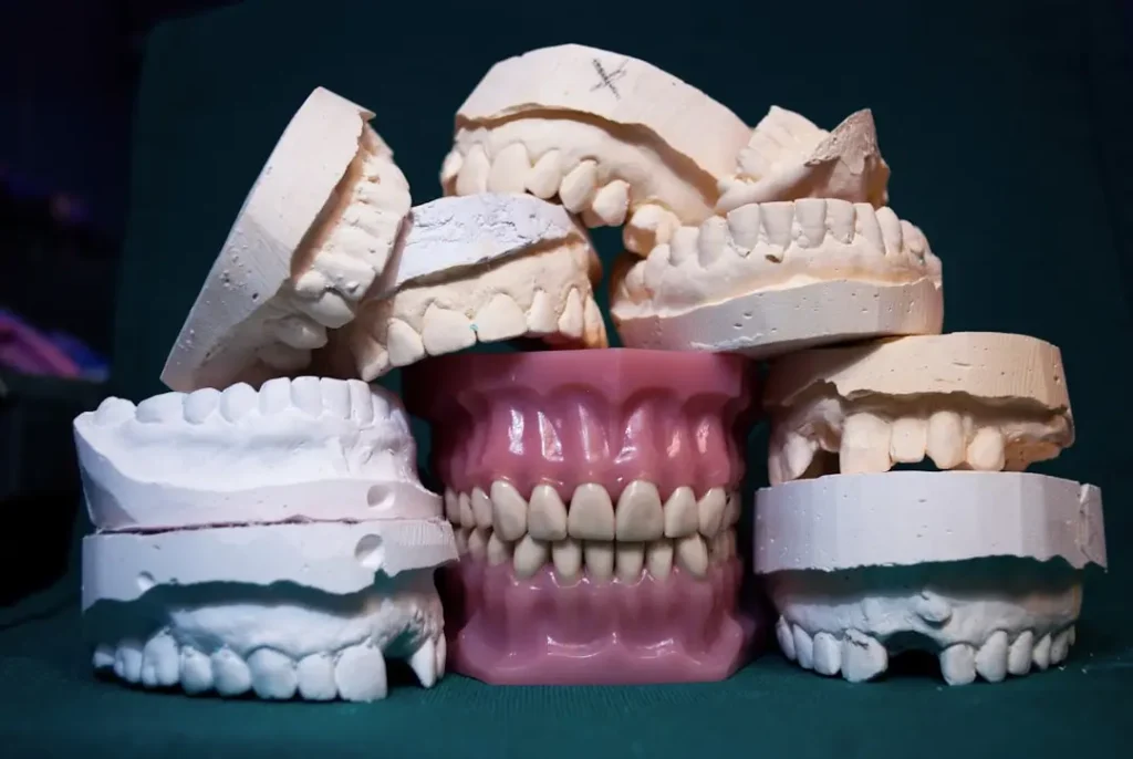 Reviewing a dental veneer treatment estimate