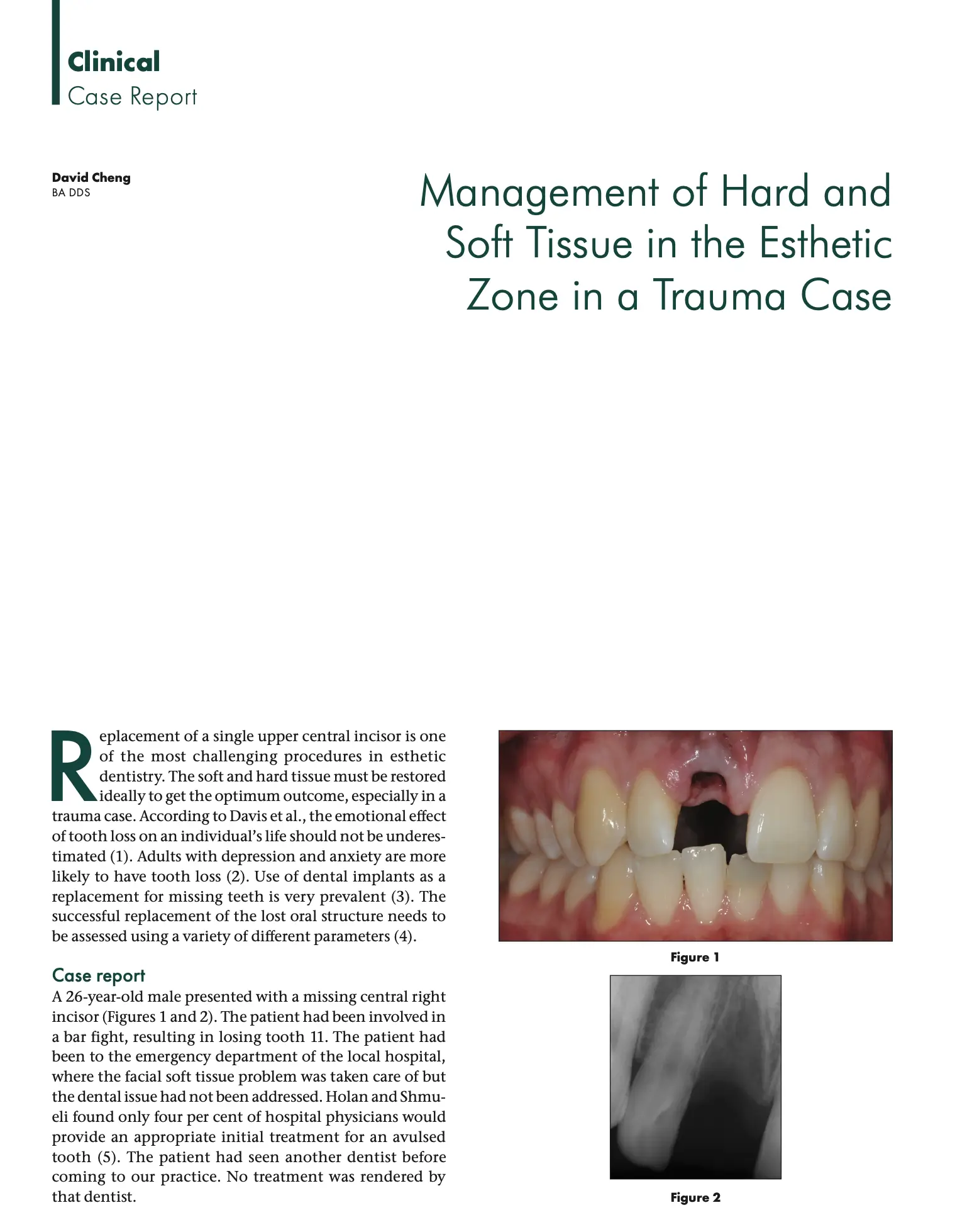 medical journal cover of a Dental implants vancouver Dr. Cheng Journal