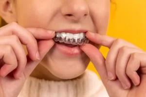 invisalign in vancouver Westcoast Smile Dental